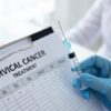 Advanced Cervical Cancer Treatment in Noida with Modern Options