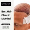 Best Hair Clinic in Mumbai for Personalized Hair Treatments