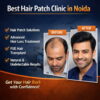 Best Hair Patch Clinic in Noida