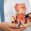 Expert Care for Piles, Fissure & Digestive Problems