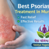 Best Psoriasis Treatment for Fast and Effective Relief