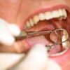 Affordable and Quality Dental Treatments Across Delhi